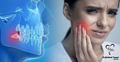 آشنایی کامل با انواع دندان عقل